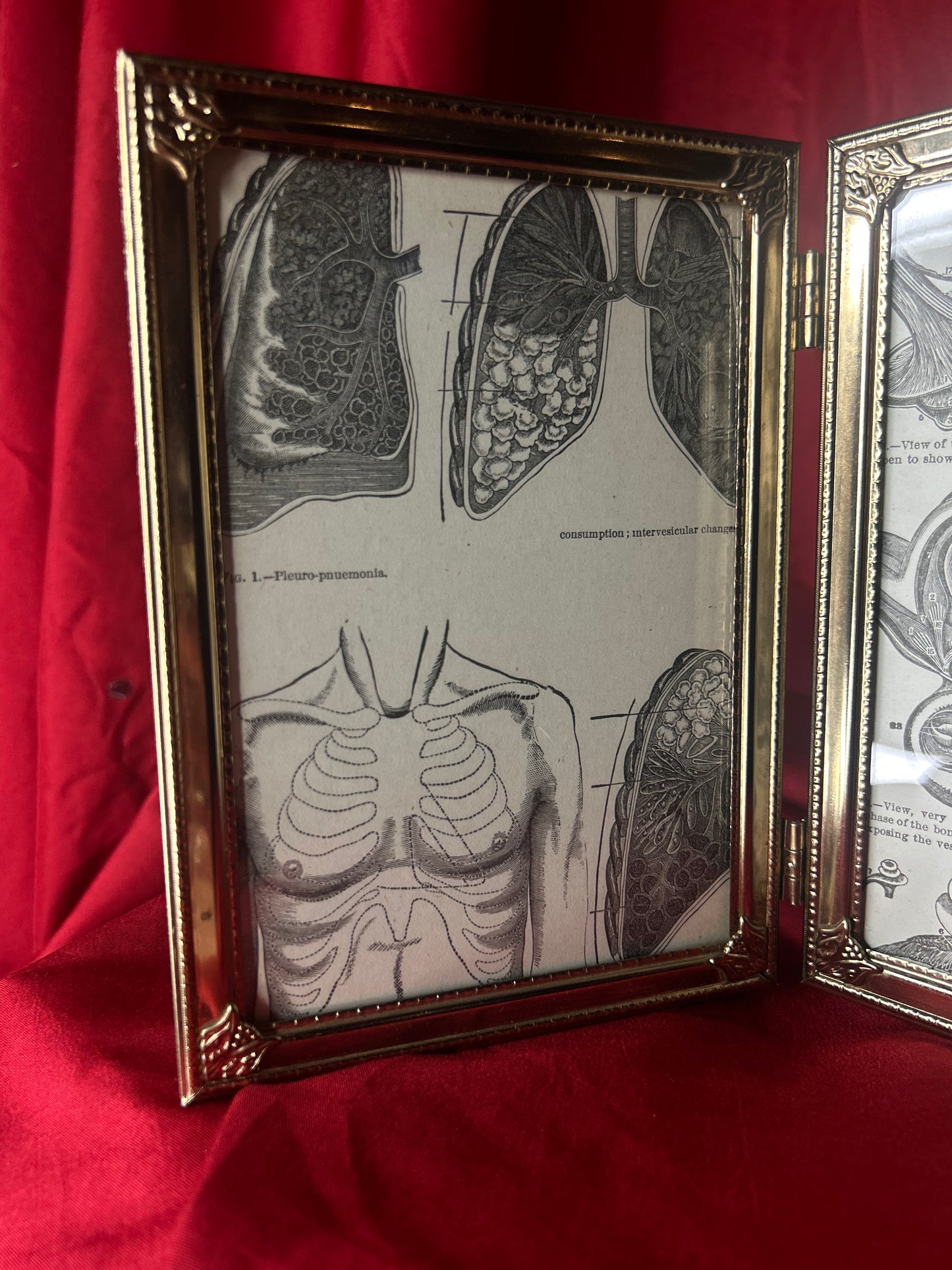 Framed Medical Antique Illustrations