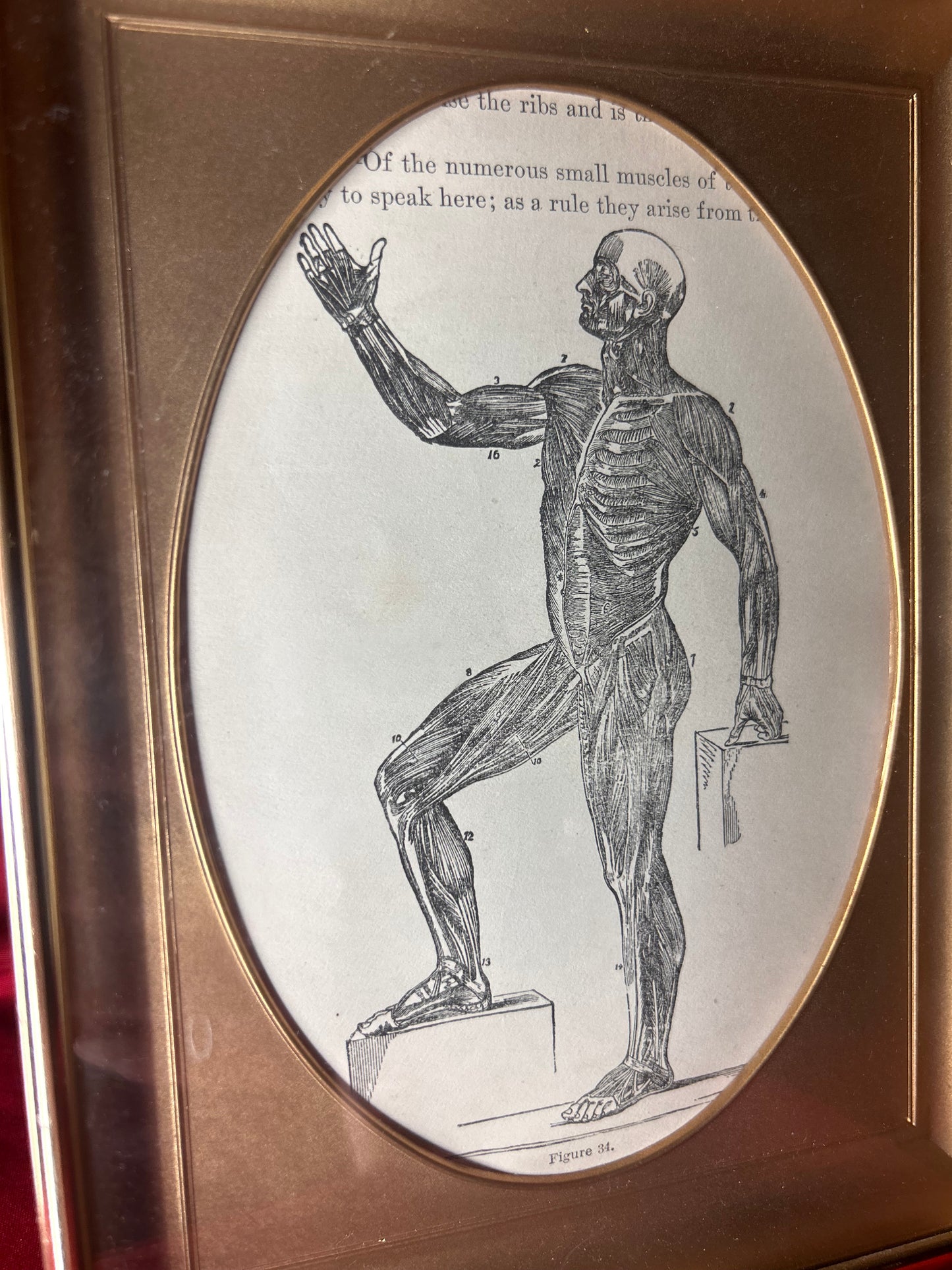 Framed Medical Antique Illustration