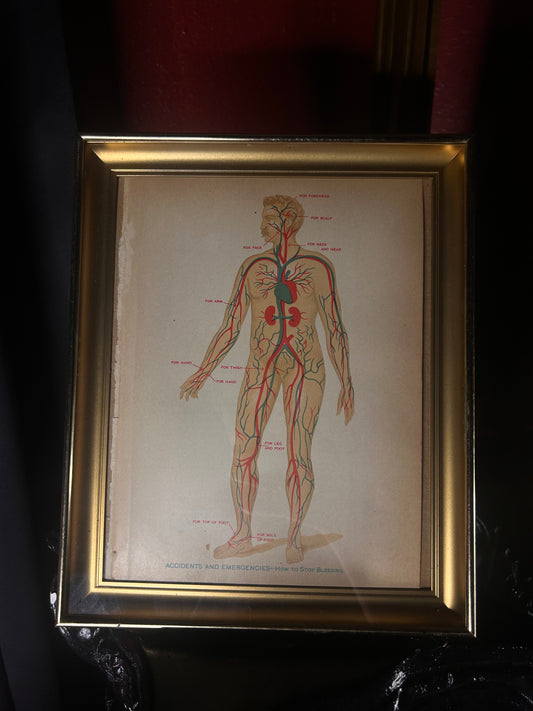 Framed Shadow Box with Original Medical Illustration