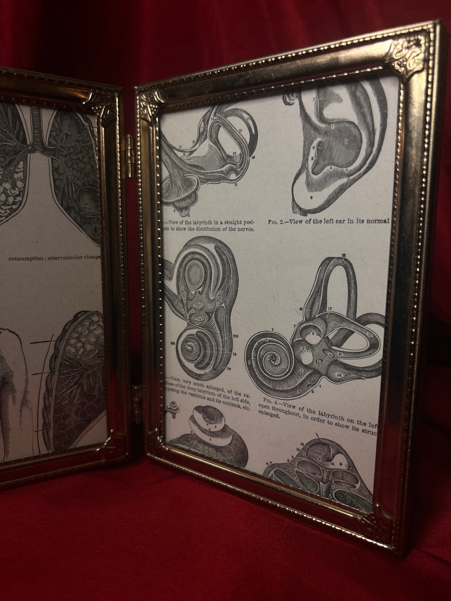 Framed Medical Antique Illustrations