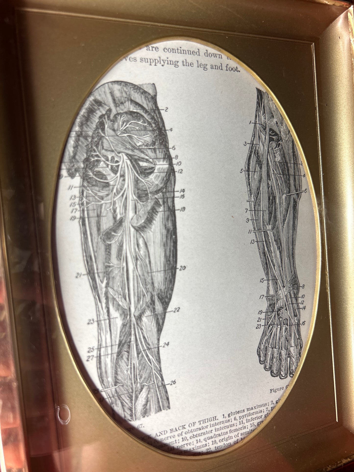 Framed Medical Antique Illustration
