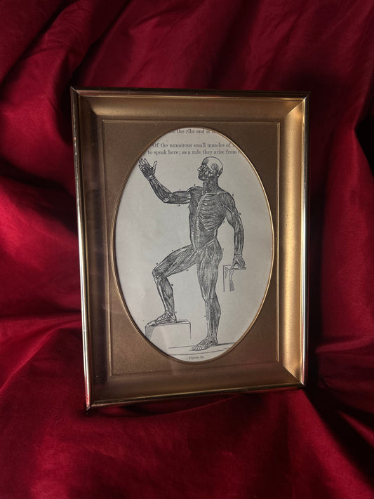 Framed Medical Antique Illustration