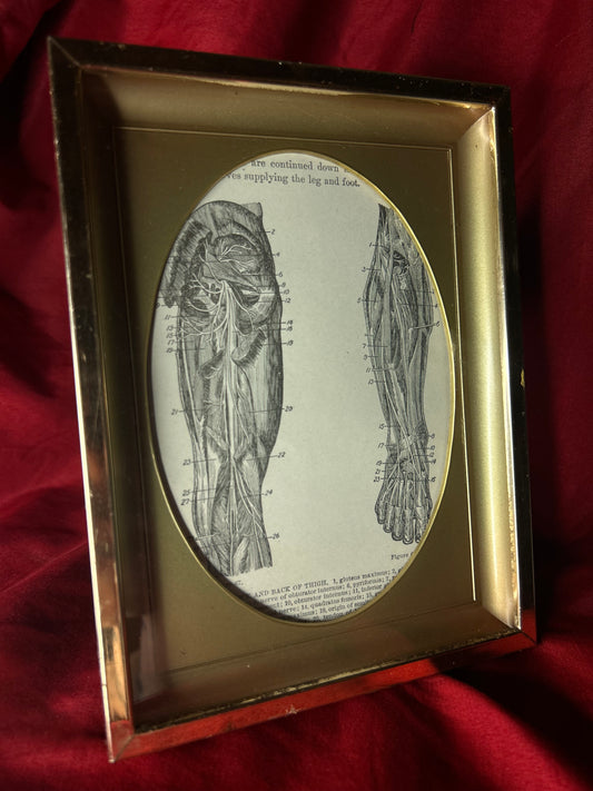 Framed Medical Antique Illustration